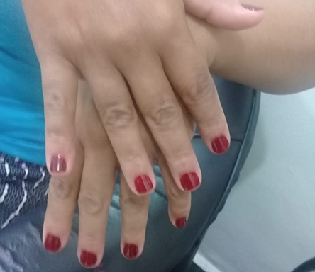 Associadas do SEECETHAR utilizam serviços de manicure e pedicure no primeiro dia de atendimento